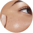 Close-up of a person's eye with visible skin texture
